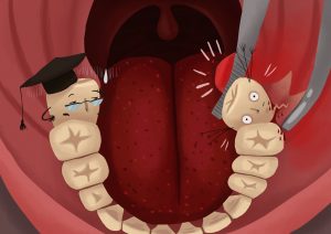 Wisdom Tooth Dentist Melbourne