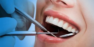 Dental Treatment