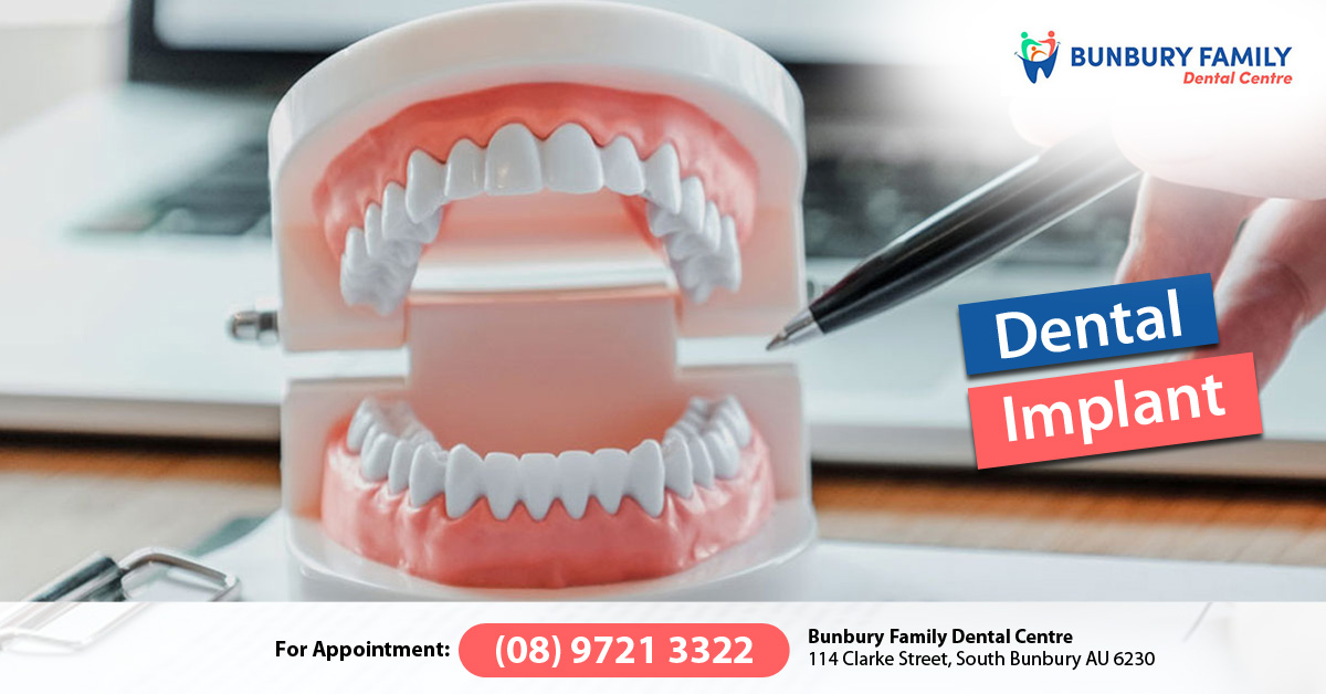 Dentist in Bunbury – Bunbury Family Dental Centre