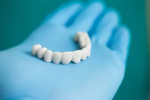 Dental Implants in Richmond