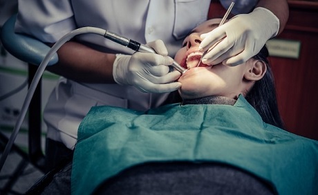 Wisdom Tooth Cavity Extraction