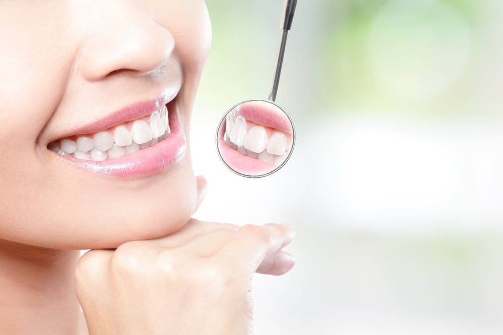 Smile Enhancement Options