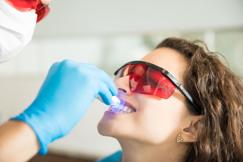dental bonding Adelaide