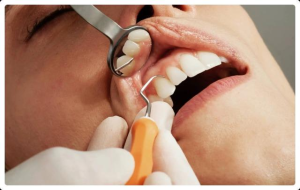 Gum Disease Treatment Melbourne CBD